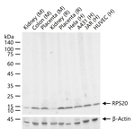 RPS20 Antibody in Western Blot (WB)