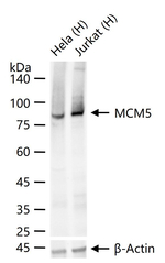 MCM5 Antibody in Western Blot (WB)