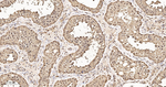 COPS3 Antibody in Immunohistochemistry (Paraffin) (IHC (P))