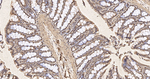 COPS3 Antibody in Immunohistochemistry (Paraffin) (IHC (P))