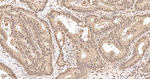 COPS3 Antibody in Immunohistochemistry (Paraffin) (IHC (P))