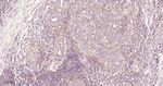 PGAM1 Antibody in Immunohistochemistry (Paraffin) (IHC (P))