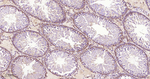 PGAM1 Antibody in Immunohistochemistry (Paraffin) (IHC (P))