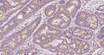 PGAM1 Antibody in Immunohistochemistry (Paraffin) (IHC (P))
