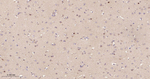 PGAM1 Antibody in Immunohistochemistry (Paraffin) (IHC (P))