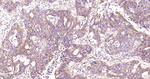 PGAM1 Antibody in Immunohistochemistry (Paraffin) (IHC (P))