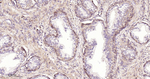PGAM1 Antibody in Immunohistochemistry (Paraffin) (IHC (P))