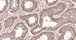 PGAM1 Antibody in Immunohistochemistry (Paraffin) (IHC (P))