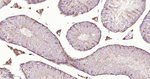 PGAM1 Antibody in Immunohistochemistry (Paraffin) (IHC (P))