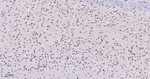 PRMT5 Antibody in Immunohistochemistry (Paraffin) (IHC (P))