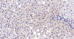 PRMT5 Antibody in Immunohistochemistry (Paraffin) (IHC (P))