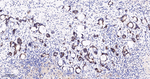 PRMT5 Antibody in Immunohistochemistry (Paraffin) (IHC (P))