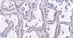 PRMT5 Antibody in Immunohistochemistry (Paraffin) (IHC (P))