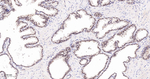 PRMT5 Recombinant Rabbit Monoclonal Antibody (D1B12)
