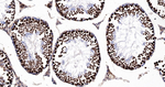 PTBP2 Antibody in Immunohistochemistry (Paraffin) (IHC (P))