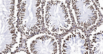 PTBP2 Antibody in Immunohistochemistry (Paraffin) (IHC (P))