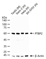 PTBP2 Antibody in Western Blot (WB)