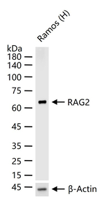 RAG2 Recombinant Rabbit Monoclonal Antibody (C5E7)