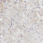 ALDH1L1 Recombinant Rabbit Monoclonal Antibody (G10H7)