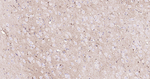 ALDH1L1 Antibody in Immunohistochemistry (Paraffin) (IHC (P))