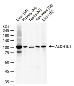 ALDH1L1 Antibody in Western Blot (WB)