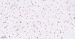 PTBP1 Antibody in Immunohistochemistry (Paraffin) (IHC (P))