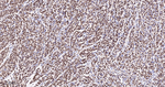 PTBP1 Antibody in Immunohistochemistry (Paraffin) (IHC (P))