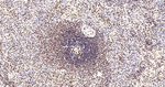 PTBP1 Antibody in Immunohistochemistry (Paraffin) (IHC (P))