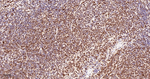 PTBP1 Antibody in Immunohistochemistry (Paraffin) (IHC (P))