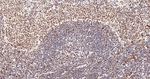 PTBP1 Antibody in Immunohistochemistry (Paraffin) (IHC (P))