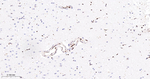 PTBP1 Antibody in Immunohistochemistry (Paraffin) (IHC (P))
