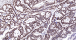 PTBP1 Antibody in Immunohistochemistry (Paraffin) (IHC (P))
