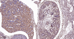 PTBP1 Antibody in Immunohistochemistry (Paraffin) (IHC (P))