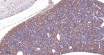 PTBP1 Antibody in Immunohistochemistry (Paraffin) (IHC (P))
