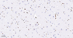 PTBP1 Antibody in Immunohistochemistry (Paraffin) (IHC (P))