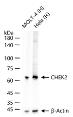 CHK2 Monoclonal Antibody (E3E7)