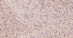 GRK2 Antibody in Immunohistochemistry (Paraffin) (IHC (P))
