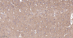 GRK2 Antibody in Immunohistochemistry (Paraffin) (IHC (P))