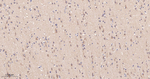 GRK2 Recombinant Rabbit Monoclonal Antibody (D3F9)