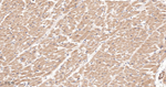 GRK2 Antibody in Immunohistochemistry (Paraffin) (IHC (P))