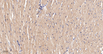 GRK2 Antibody in Immunohistochemistry (Paraffin) (IHC (P))