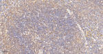 GRK2 Antibody in Immunohistochemistry (Paraffin) (IHC (P))