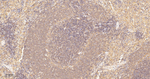 GRK2 Antibody in Immunohistochemistry (Paraffin) (IHC (P))