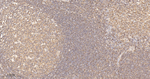 GRK2 Antibody in Immunohistochemistry (Paraffin) (IHC (P))