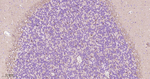 PHGDH Antibody in Immunohistochemistry (Paraffin) (IHC (P))