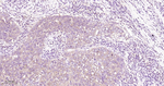 PHGDH Antibody in Immunohistochemistry (Paraffin) (IHC (P))