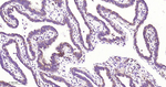 PHGDH Antibody in Immunohistochemistry (Paraffin) (IHC (P))