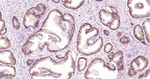PHGDH Antibody in Immunohistochemistry (Paraffin) (IHC (P))