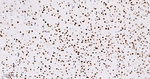 RbAp48 Antibody in Immunohistochemistry (Paraffin) (IHC (P))