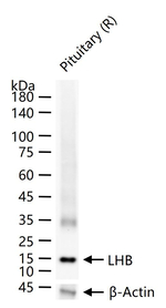 LH-beta Antibody in Western Blot (WB)